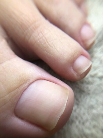 Gelpolish op tenen & Esthetische Pedicure 